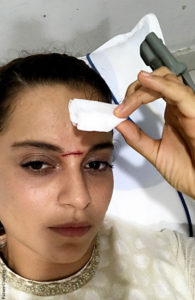 kangana-ranaut-injured